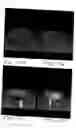 Fig. 12 - Devices and methods for attachment of a gastrointestinal sleeve