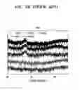 Fig. 04 - Semiconductor device doped with Sb, Ga or Bi and method of manufacturing the same
