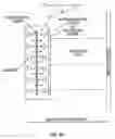 Fig. 07 - Ferromagnetic detection pillar