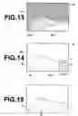 Fig. 06 - Breast image display apparatus and program therefor