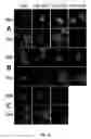 Fig. 17 - Cell permeable nanoconjugates of shell-crosslinked knedel (SCK) and peptide nucleic acids (“PNAs”) with uniquely expressed or over-expressed mRNA targeting sequences for early diagnosis and therapy of cancer
