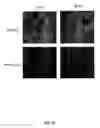 Fig. 31 - Cell permeable nanoconjugates of shell-crosslinked knedel (SCK) and peptide nucleic acids (“PNAs”) with uniquely expressed or over-expressed mRNA targeting sequences for early diagnosis and therapy of cancer