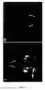 Fig. 40 - Cell permeable nanoconjugates of shell-crosslinked knedel (SCK) and peptide nucleic acids (“PNAs”) with uniquely expressed or over-expressed mRNA targeting sequences for early diagnosis and therapy of cancer
