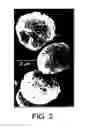 Fig. 05 - Pulmonary delivery particles with phospholipid structural matrix