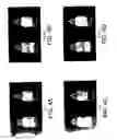 Fig. 06 - Pulmonary delivery particles with phospholipid structural matrix