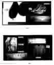 Fig. 03 - Tissue graft scaffold made from cholecyst-derived extracellular matrix