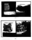 Fig. 04 - Tissue graft scaffold made from cholecyst-derived extracellular matrix