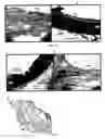 Fig. 09 - Tissue graft scaffold made from cholecyst-derived extracellular matrix