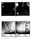 Fig. 12 - Tissue graft scaffold made from cholecyst-derived extracellular matrix