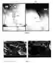 Fig. 13 - Tissue graft scaffold made from cholecyst-derived extracellular matrix