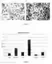 Fig. 17 - Tissue graft scaffold made from cholecyst-derived extracellular matrix