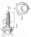 Fig. 02 - Apparatus and method for anchoring a dental appliance