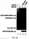 Fig. 07 - Three-dimensional structures of HDAC9 and Cabin1 and compound structures and methods related thereto