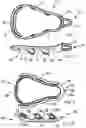 Fig. 02 - Two piece lacrosse stick head