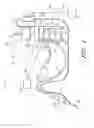 Fig. 02 - Surgical file system with a visualization instrument