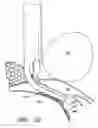 Fig. 53 - Surgical file system with a visualization instrument