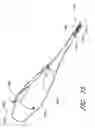 Fig. 69 - Surgical file system with a visualization instrument