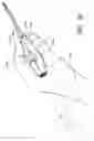 Fig. 82 - Surgical file system with a visualization instrument