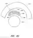 Fig. 84 - Surgical file system with a visualization instrument
