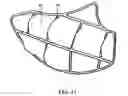 Fig. 10 - Tissue augmentation device