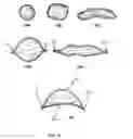 Fig. 11 - Tissue augmentation device
