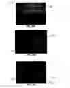 Fig. 20 - Tissue augmentation device