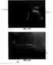 Fig. 25 - Tissue augmentation device