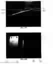 Fig. 28 - Tissue augmentation device