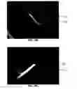 Fig. 29 - Tissue augmentation device