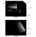 Fig. 36 - Tissue augmentation device