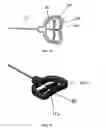 Fig. 41 - Tissue augmentation device