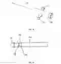 Fig. 43 - Tissue augmentation device