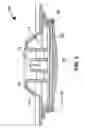 Fig. 02 - Filter housing for a drinking water pitcher
