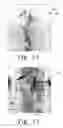 Fig. 08 - Frequency-based surveillance imaging