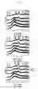 Fig. 05 - Composite material containing a calcium phosphate gradient