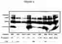 Fig. 07 - Humanized antibodies that recognize beta amyloid peptide