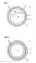 Fig. 02 - Coated stent