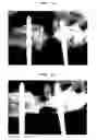 Fig. 07 - Bone-filling composition for stimulating bone-forming and bone-consolidation comprising calcium sulfate and viscous biopolymers