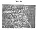 Fig. 09 - Bone-filling composition for stimulating bone-forming and bone-consolidation comprising calcium sulfate and viscous biopolymers