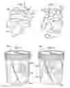 Fig. 05 - Method for controlling bulk density of fried snack pieces