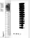 Fig. 02 - Detection of protease-resistant prion protein following a spontaneous transformation reaction