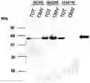 Fig. 01 - Bacterial outer memberane vesicles