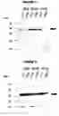 Fig. 02 - Bacterial outer memberane vesicles