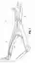 Fig. 02 - Reducing instrument for spinal surgery