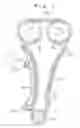 Fig. 02 - Hydraulic chain tensioner