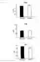 Fig. 09 - Method for treating arteriosclerosis