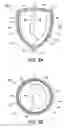 Fig. 09 - Method and apparatus for direct mechanical ventricular actuation with favorable conditioning and minimal heart stress
