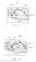 Fig. 06 - System and method for detecting cardiovascular health conditions using hemodynamic pressure waveforms