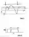 Fig. 10 - External counterpulsation system and method for minimizing end diastolic pressure