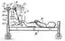 Fig. 01 - Method and apparatus for minimizing bed sores and lower back pain in spinal injury patients